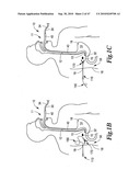 SURGICAL INSTRUMENTS FOR IN VIVO ASSEMBLY diagram and image