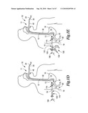 SURGICAL INSTRUMENTS FOR IN VIVO ASSEMBLY diagram and image