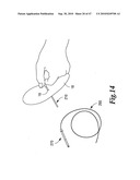 SURGICAL INSTRUMENTS FOR IN VIVO ASSEMBLY diagram and image