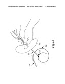 SURGICAL INSTRUMENTS FOR IN VIVO ASSEMBLY diagram and image