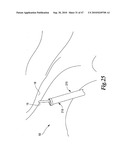 SURGICAL INSTRUMENTS FOR IN VIVO ASSEMBLY diagram and image