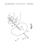 SURGICAL INSTRUMENTS FOR IN VIVO ASSEMBLY diagram and image