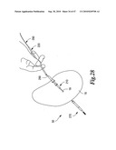 SURGICAL INSTRUMENTS FOR IN VIVO ASSEMBLY diagram and image