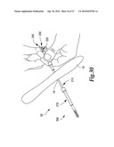 SURGICAL INSTRUMENTS FOR IN VIVO ASSEMBLY diagram and image