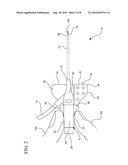 SYSTEMS AND METHODS FOR PROVIDING A CONVENTIONAL INTEGRATED CATHETER WITH UNIVERSAL GRIP diagram and image