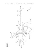 SYSTEMS AND METHODS FOR PROVIDING A CONVENTIONAL INTEGRATED CATHETER WITH UNIVERSAL GRIP diagram and image