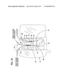 Administration Feeding Set diagram and image