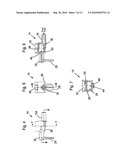 Administration Feeding Set diagram and image