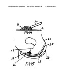 Sanitary enhanced absorption wick device diagram and image