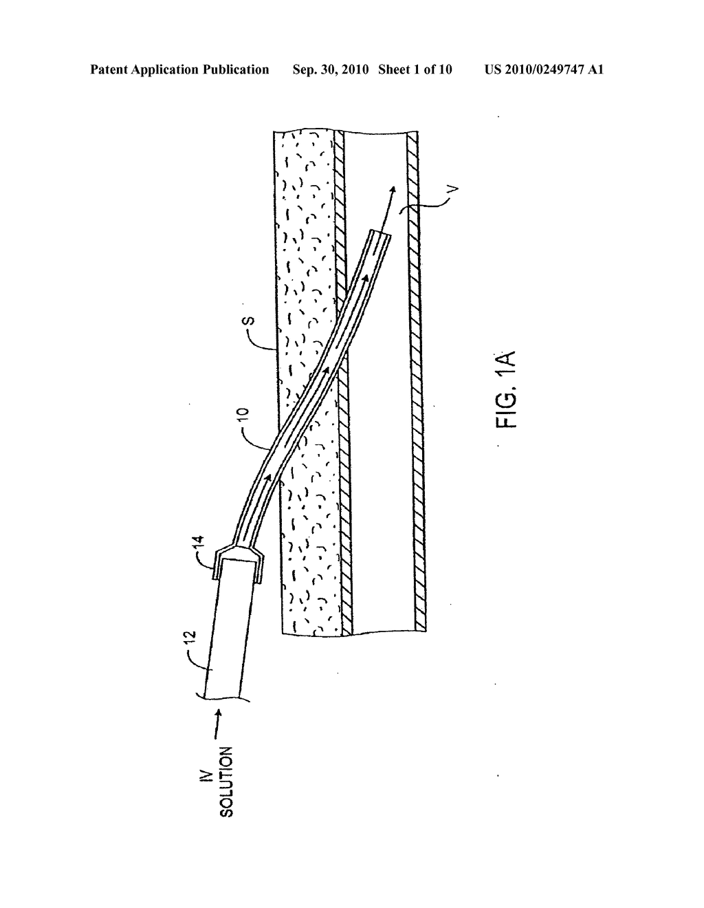 Transdermal venous access locking solution - diagram, schematic, and image 02