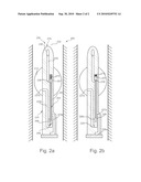 Pressure-controlled balloon catheter diagram and image