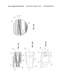 LINK SYSTEMS AND ARTICULATION MECHANISMS FOR REMOTE MANIPULATION OF SURGICAL OF DIAGNOSTIC TOOLS diagram and image