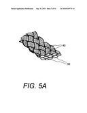 POLYMER COMPOSITES FOR BIOMEDICAL APPLICATIONS AND METHODS OF MAKING diagram and image