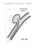 POLYMER COMPOSITES FOR BIOMEDICAL APPLICATIONS AND METHODS OF MAKING diagram and image