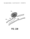 POLYMER COMPOSITES FOR BIOMEDICAL APPLICATIONS AND METHODS OF MAKING diagram and image