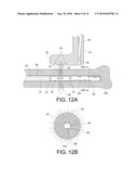 INTRAMEDULLARY NAIL TARGETING DEVICE diagram and image