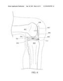 SYSTEM AND METHOD FOR ORTHOPEDIC DYNAMIC DISTRACTION diagram and image