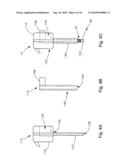 THREADABLE KNOT SOFT TISSUE DEFECT REPAIR SYSTEM diagram and image