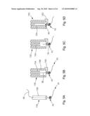 THREADABLE KNOT SOFT TISSUE DEFECT REPAIR SYSTEM diagram and image