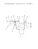 THREADABLE KNOT SOFT TISSUE DEFECT REPAIR SYSTEM diagram and image