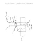 THREADABLE KNOT SOFT TISSUE DEFECT REPAIR SYSTEM diagram and image