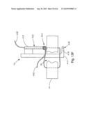 THREADABLE KNOT SOFT TISSUE DEFECT REPAIR SYSTEM diagram and image