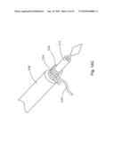 THREADABLE KNOT SOFT TISSUE DEFECT REPAIR SYSTEM diagram and image