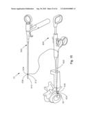 THREADABLE KNOT SOFT TISSUE DEFECT REPAIR SYSTEM diagram and image