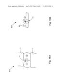 THREADABLE KNOT SOFT TISSUE DEFECT REPAIR SYSTEM diagram and image