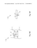 THREADABLE KNOT SOFT TISSUE DEFECT REPAIR SYSTEM diagram and image