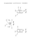 THREADABLE KNOT SOFT TISSUE DEFECT REPAIR SYSTEM diagram and image