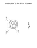 THREADABLE KNOT SOFT TISSUE DEFECT REPAIR SYSTEM diagram and image