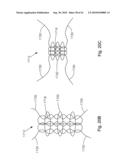 THREADABLE KNOT SOFT TISSUE DEFECT REPAIR SYSTEM diagram and image