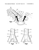 METHOD FOR INTERCONNECTING LONGITUDINAL MEMBERS EXTENDING ALONG A SPINAL COLUMN diagram and image