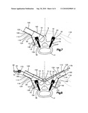 METHOD FOR INTERCONNECTING LONGITUDINAL MEMBERS EXTENDING ALONG A SPINAL COLUMN diagram and image