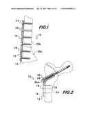 Orthopedic Fixation Device with Bioresorbable Layer diagram and image