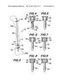 Orthopedic Fixation Device with Bioresorbable Layer diagram and image