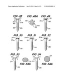 Orthopedic Fixation Device with Bioresorbable Layer diagram and image