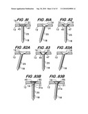 Orthopedic Fixation Device with Bioresorbable Layer diagram and image