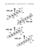 Orthopedic Fixation Device with Bioresorbable Layer diagram and image