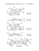 Orthopedic plate for use in small bone repair diagram and image