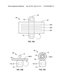 ELECTRICAL STIMULATION OF ILIOHYPOGASTRIC NERVE TO ALLEVIATE CHRONIC PELVIC PAIN diagram and image