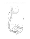 COMMUNICATION SYSTEM FOR MEDICAL DEVICES diagram and image