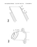 DEVICE FOR IMPLANTING A VASCULAR PROSTHESIS diagram and image