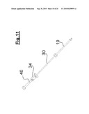 DEVICE FOR IMPLANTING A VASCULAR PROSTHESIS diagram and image