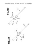 DEVICE FOR IMPLANTING A VASCULAR PROSTHESIS diagram and image