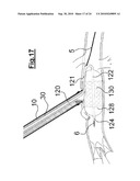 DEVICE FOR IMPLANTING A VASCULAR PROSTHESIS diagram and image