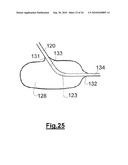 DEVICE FOR IMPLANTING A VASCULAR PROSTHESIS diagram and image