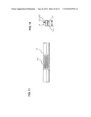 IMPLANT AND A SYSTEM AND METHOD FOR PROCESSING, DESIGING AND MANUFACTURING AN IMPROVED ORTHOPEDIC IMPLANT diagram and image