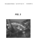 MEDICAL DEVICES WITH GALVANIC PARTICULATES diagram and image